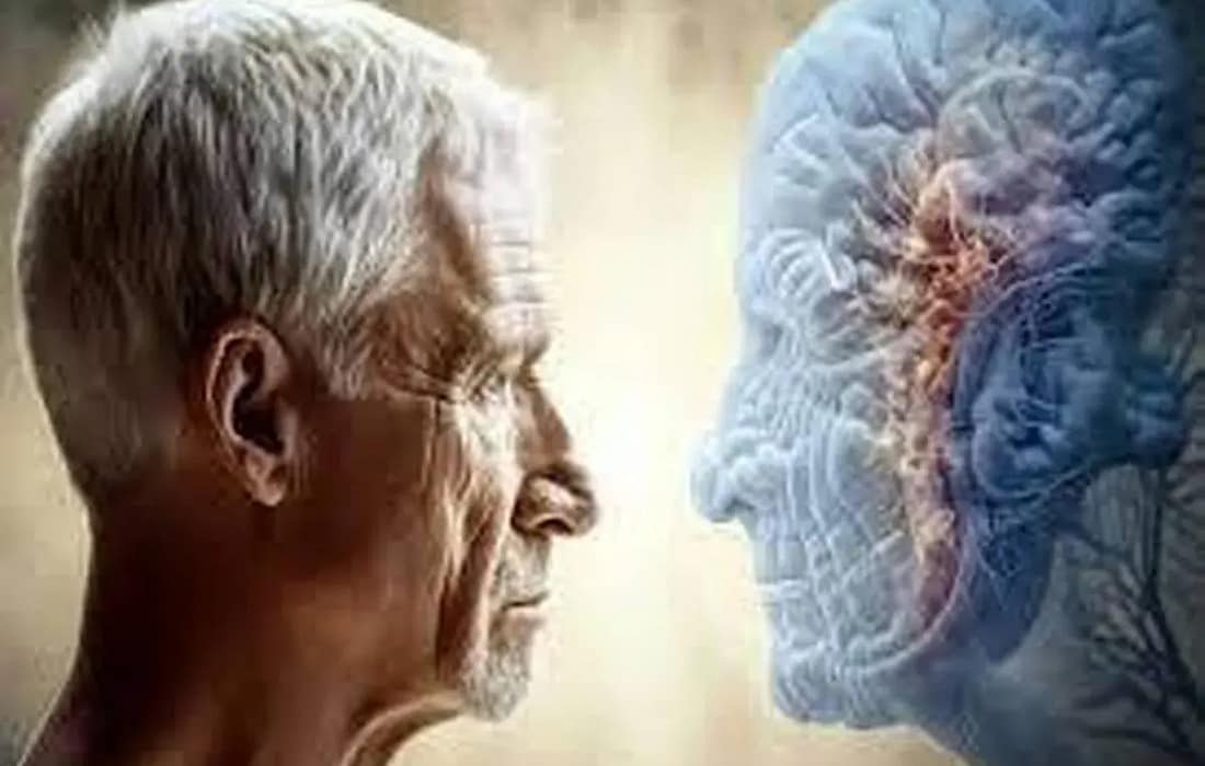 اثرات پنهان آلودگی هوا بر «پیری زودرس مغز»